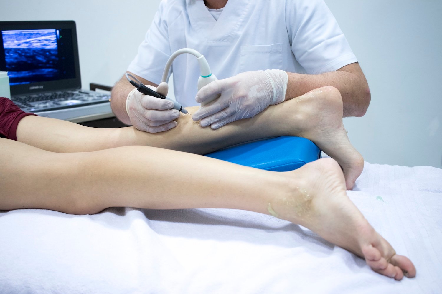 Диагностика варикоза