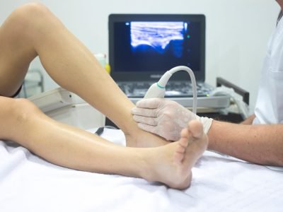 Дуплексное сканирование вен ног